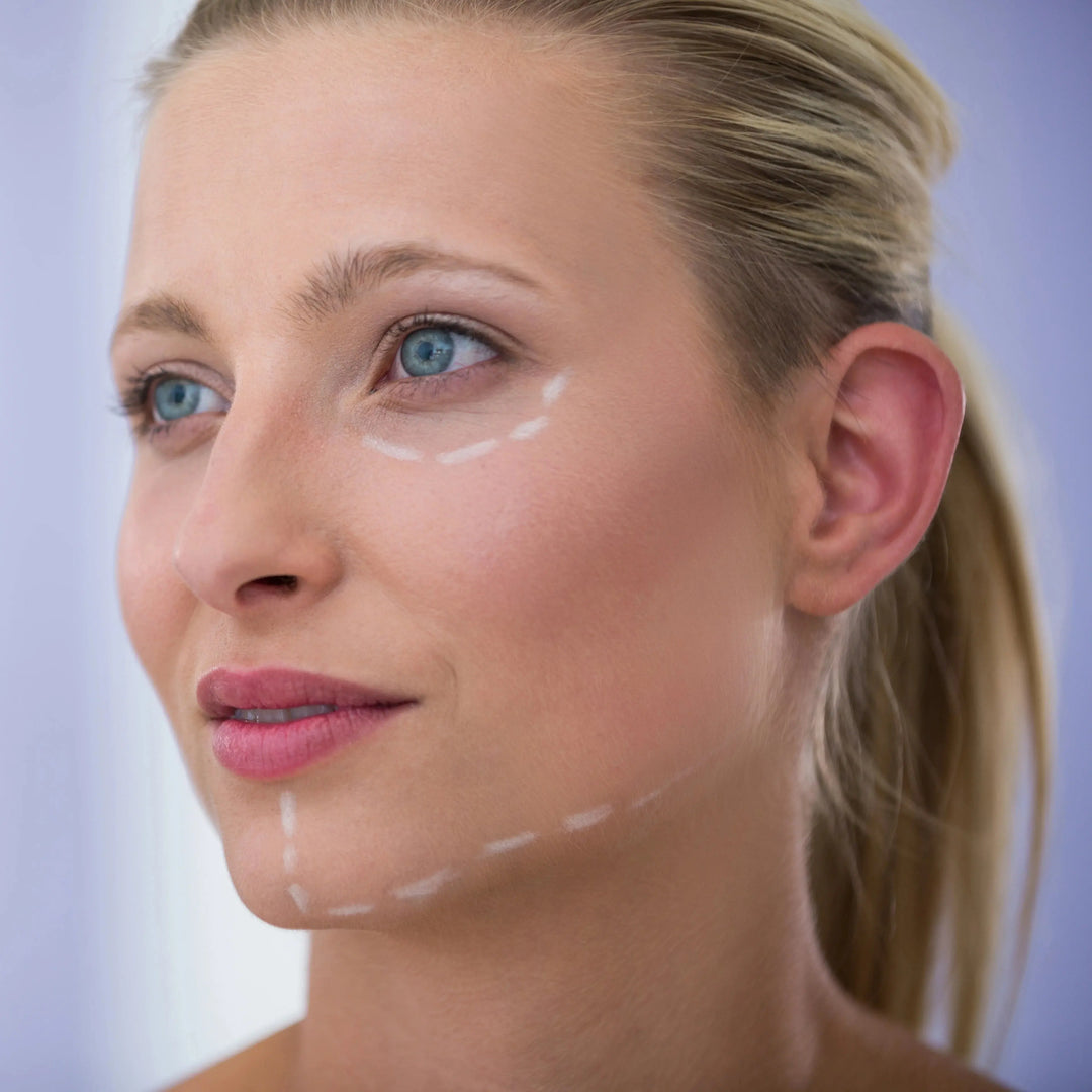 woman-with-marks-drawn-cosmetic-treatment_56cf3184-5b19-4804-96de-6f6a105c5c5a